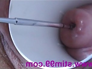 asian,woman,cervix,sounds,gyno